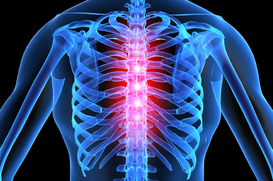 Грудной межреберный остеохондроз. Остеохондроз грудной клетки.